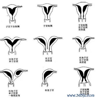 丹东试管婴儿助孕第四代费用情况解析